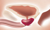 Bladder & Prostrate Health