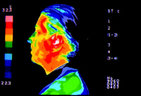 electro magnetic radiation