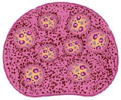 lymphatic cleansing