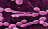 Candida Cleansing