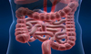 Colon Cleansing