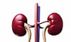 Kidney Cleansing